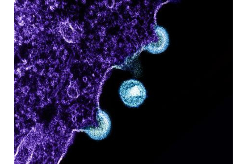 HIV Antibodies
